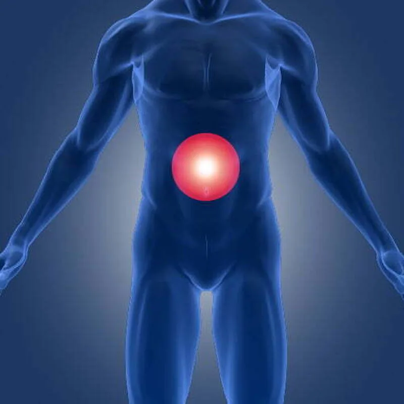 Abdominal Wall & Groin Hernia Support